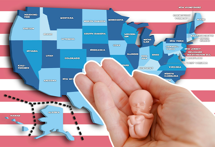 Das wird Ungeborene freuen: US-Bundesstaaten könnten wieder härtere Abtreibungsgesetze erlassen.